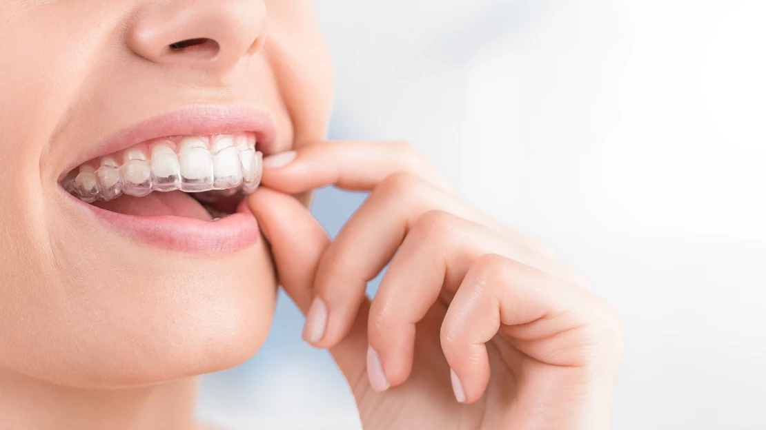 What is Invisalign and what are the benefits? BLVD Dentistry & Orthodontics,  AZ